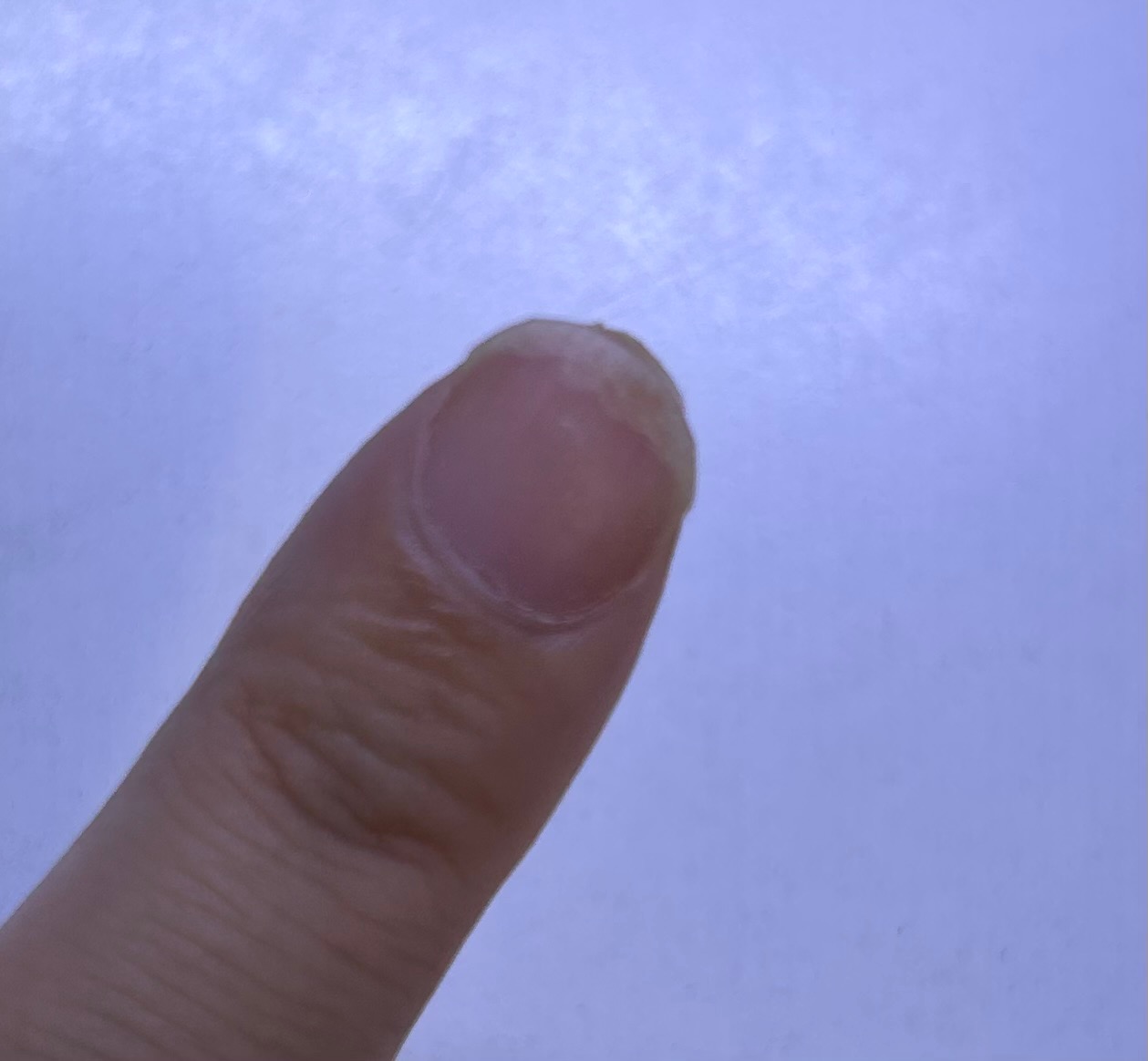 손톱이 들려서 허얘졌는데 허연부분 깎아야하나요 ㅣ 궁금할 땐, 아하!