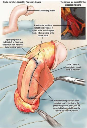 페이로니 1.PNG 이미지