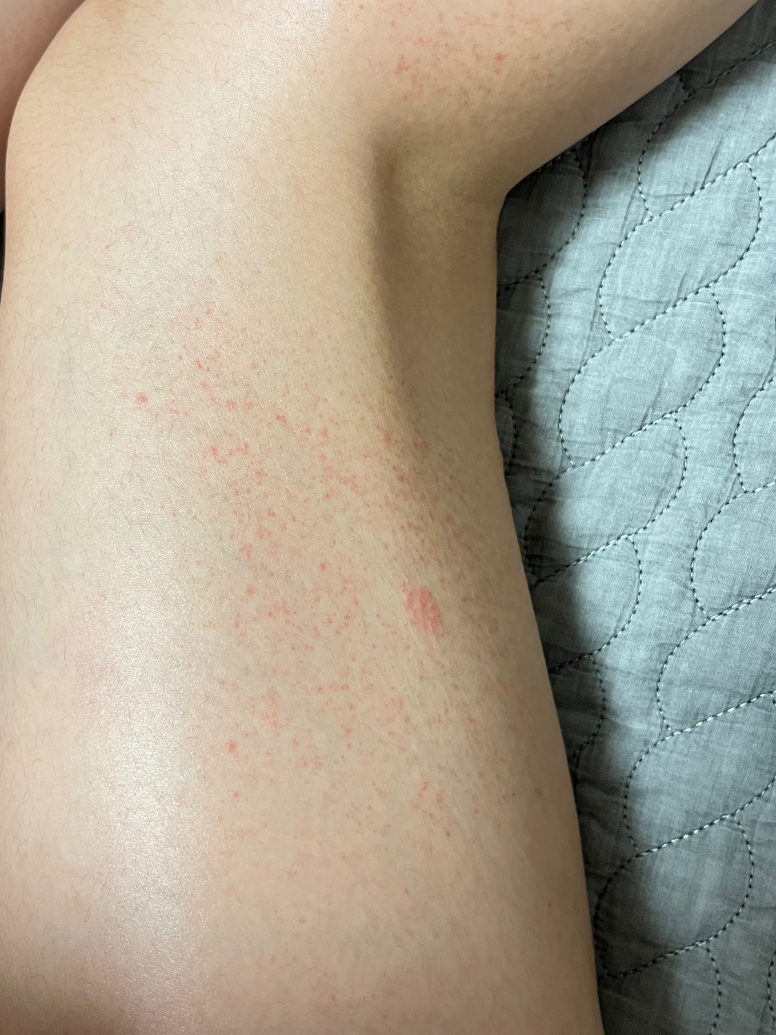 몸에 붉은 반점이 자꾸 생기고 번집니다.. ㅣ 궁금할 땐, 아하!