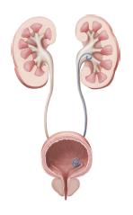 결석 6.PNG 이미지