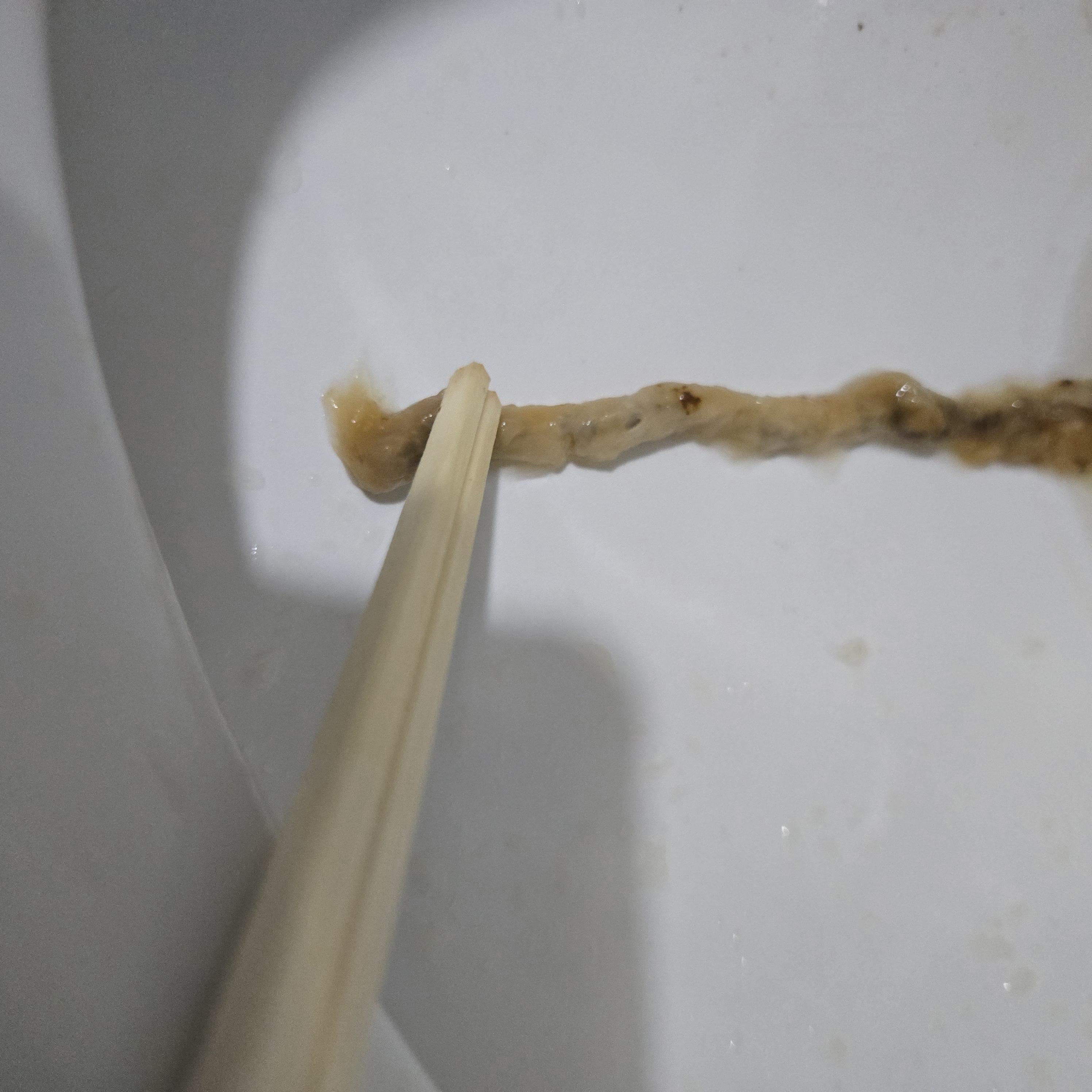 배변에 곱창처럼 하얗고 긴 막 덩어리가 나왔어요...사진 더러움주의ㅜㅜ ㅣ 궁금할 땐, 아하!