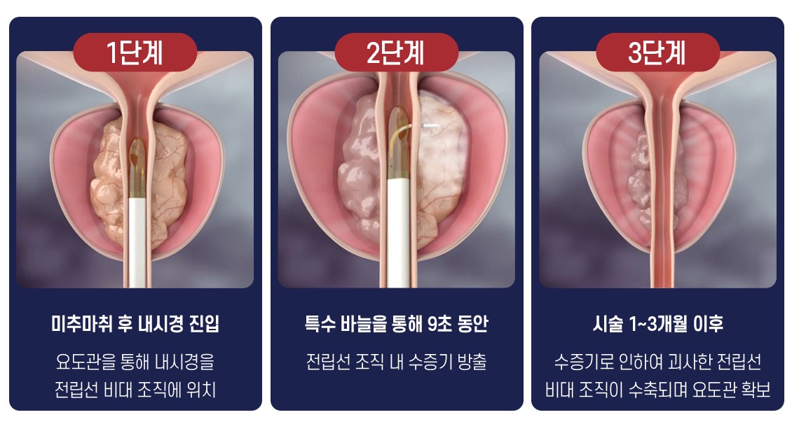 holep-icon1_01_s1.png 이미지