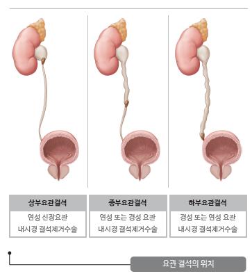 결석 5.PNG 이미지