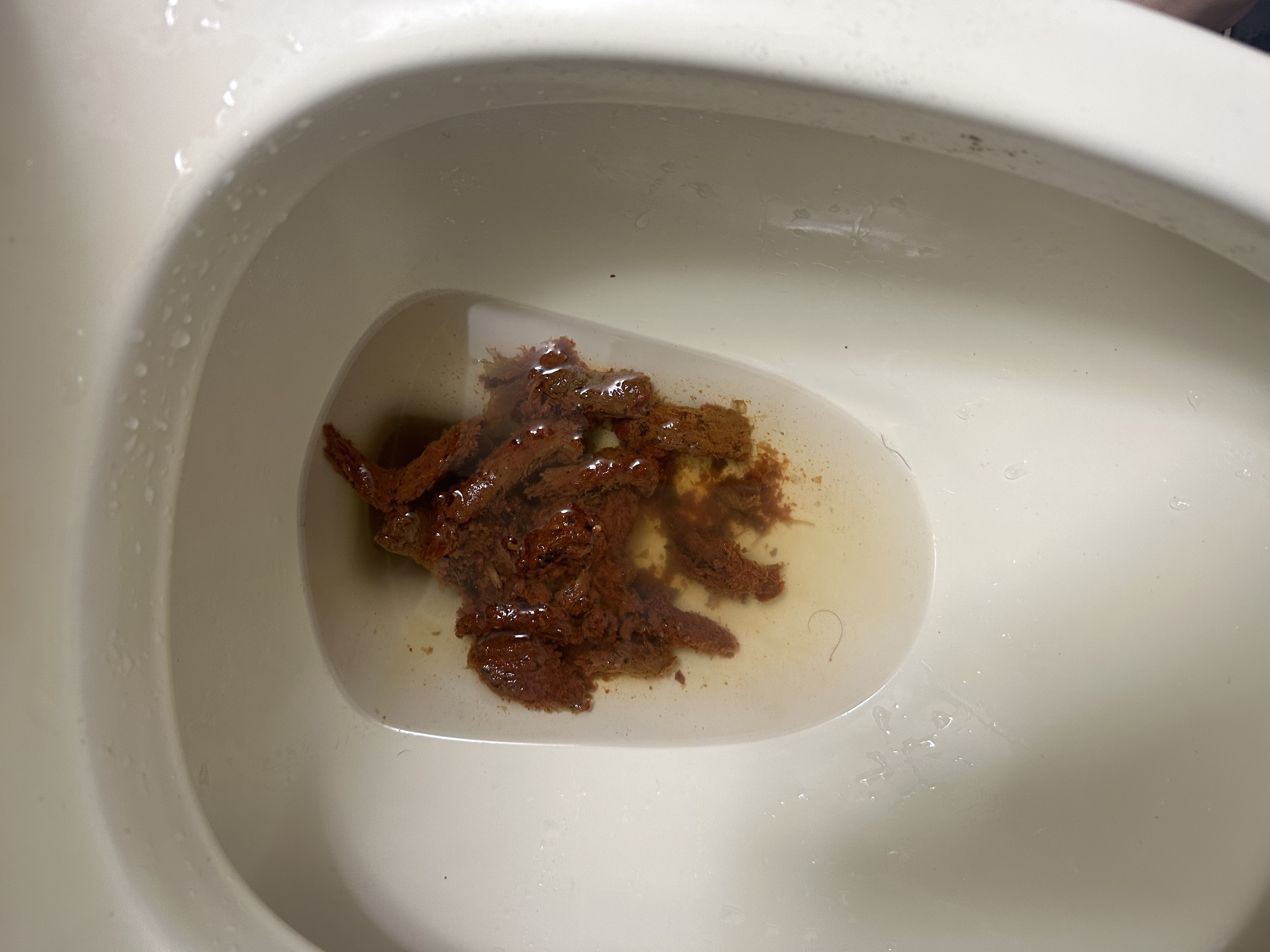 이 변 중간중간에 색이 진한 부분이 있는데 혈변인가요? ㅣ 궁금할 땐, 아하!