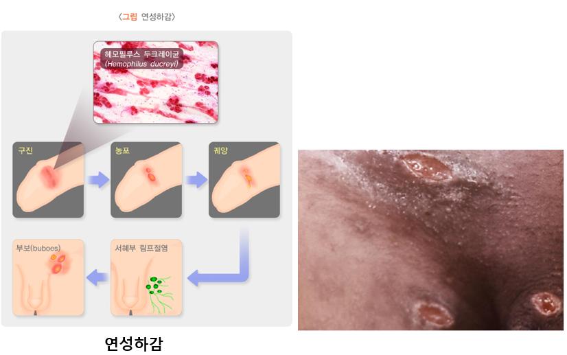 연성하감.PNG 이미지