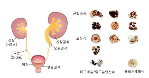 결석 1.PNG 이미지