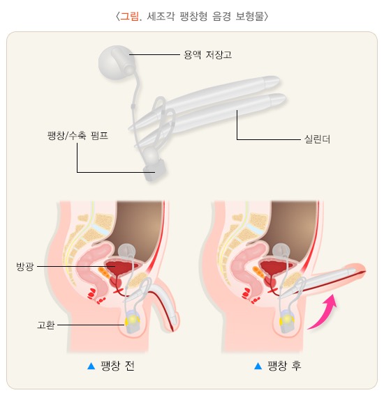 3edf20a5-0a3e-4a87-879a-b18e86525a74.jpg 이미지