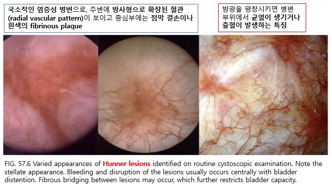 CPPS 3.PNG 이미지