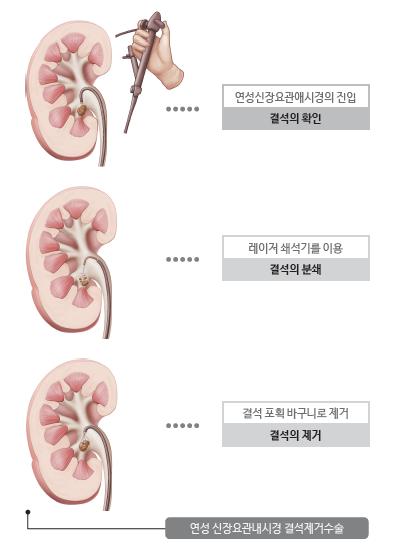 결석 4.PNG 이미지