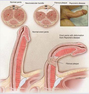 페이로니 2.PNG 이미지