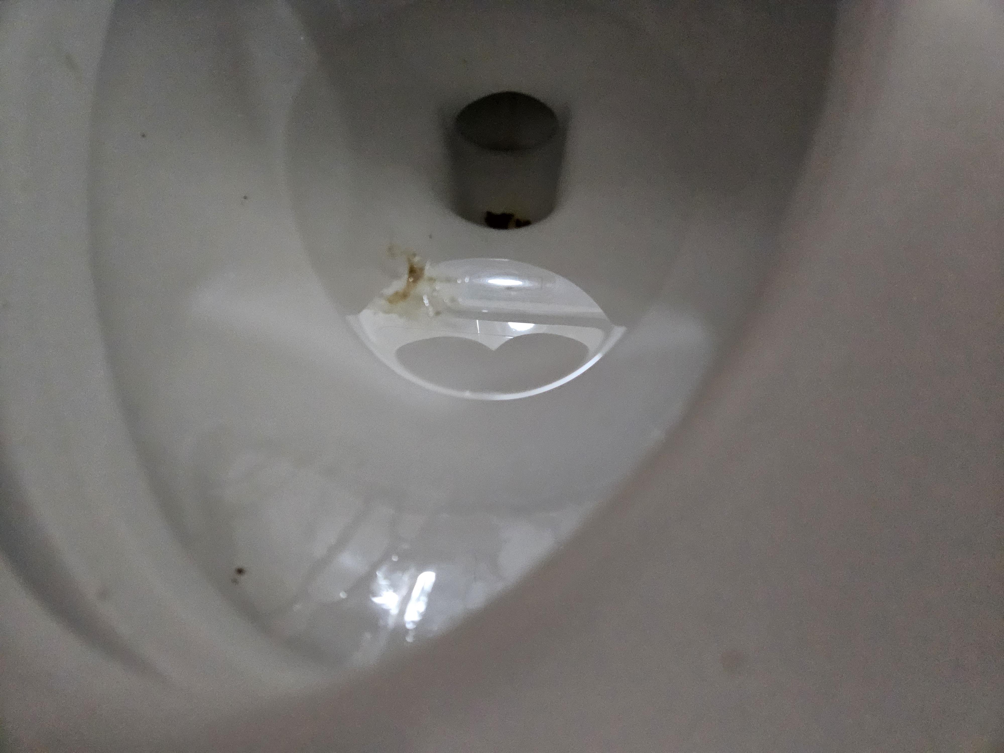똥싸다가 이상한게 나왔습니다 이게먼가요 ㅣ 궁금할 땐, 아하!