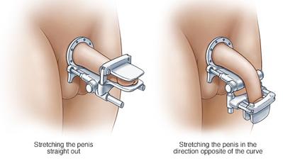 페이로니 4.PNG 이미지