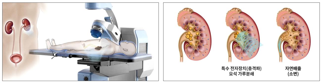 결석 23.PNG 이미지