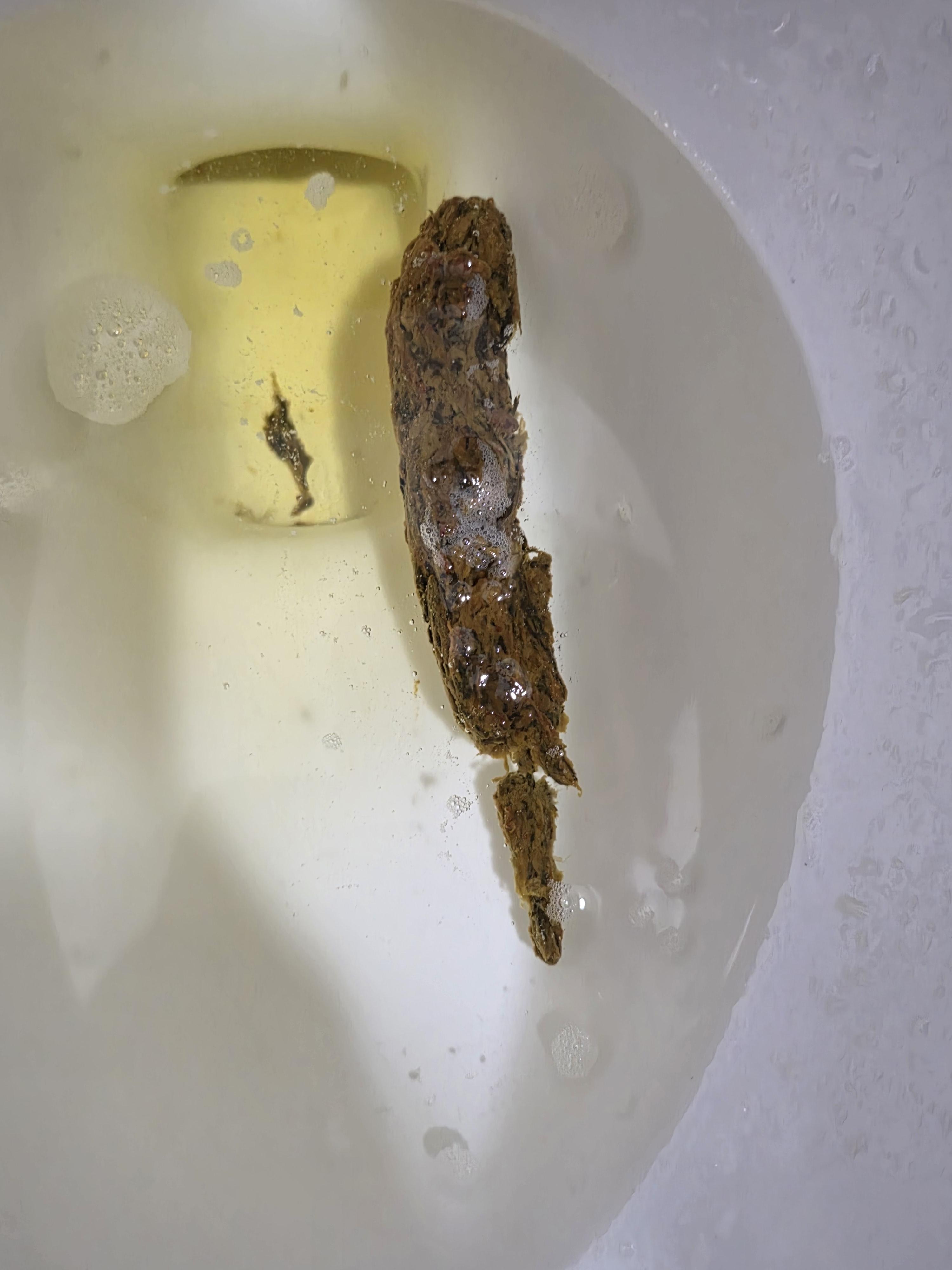 대변색이 조금 곳곳에 검은부분이 보이는데 흑변인지 궁금합니다. ㅣ 궁금할 땐, 아하!