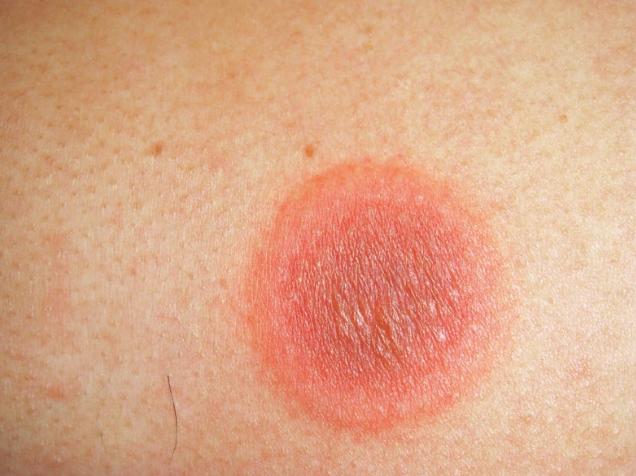 고정약진.PNG 이미지