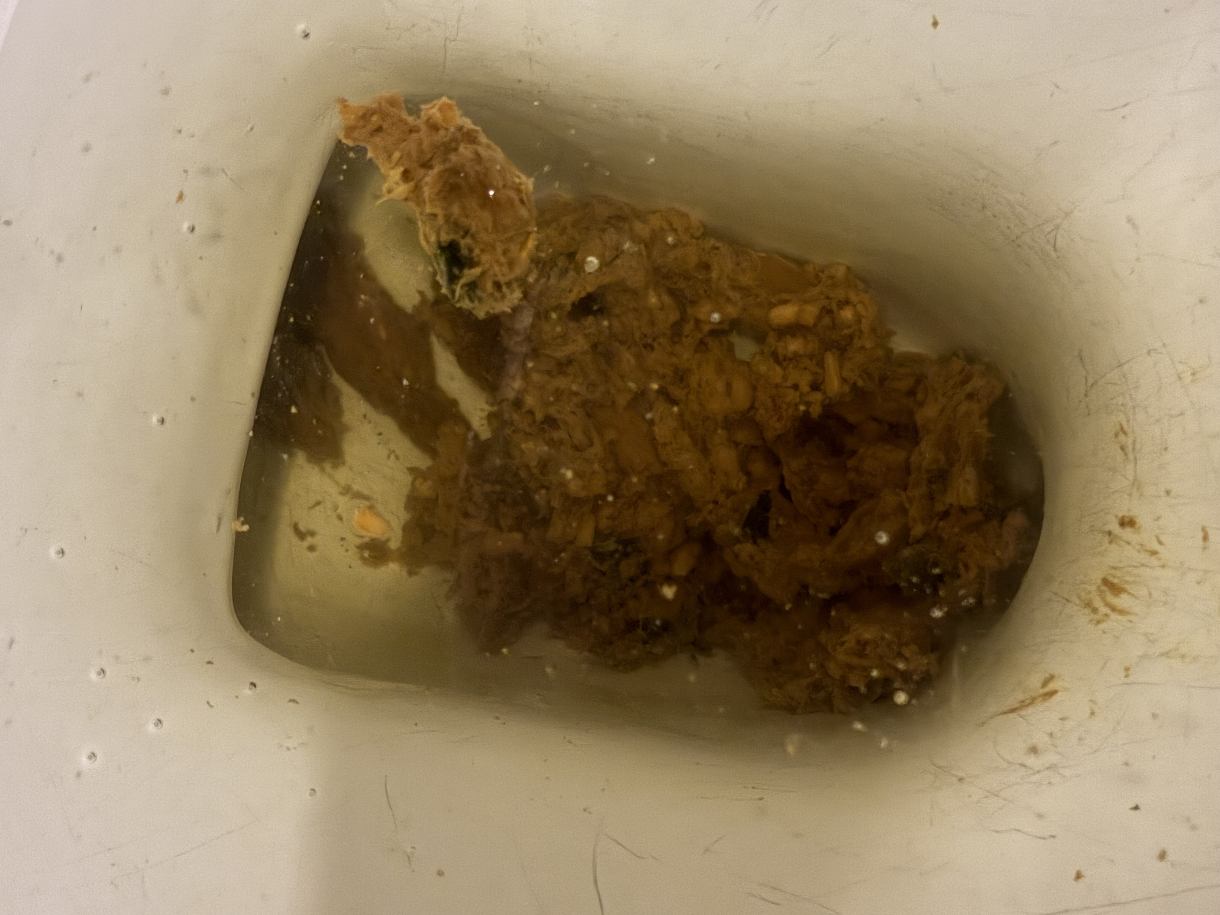 이런 것도 흑변인가요? 변에 초코칩 같은게 붙어있어요 ㅣ 궁금할 땐, 아하!