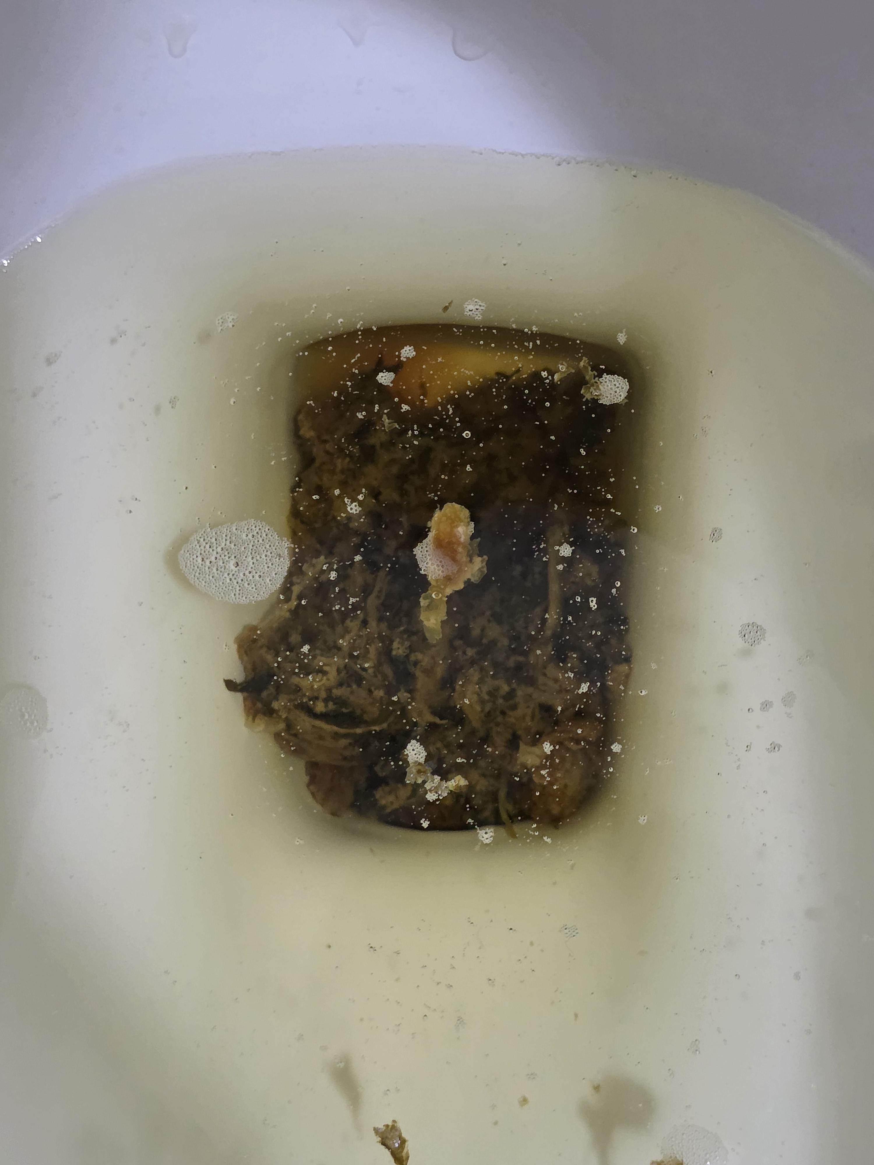 대변색이 조금 곳곳에 검은부분이 보이는데 흑변인지 궁금합니다. ㅣ 궁금할 땐, 아하!