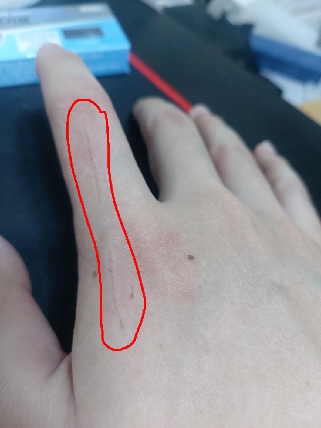 길고양이 할큄 상처 병원에 가야할까요? ㅣ 궁금할 땐, 아하!