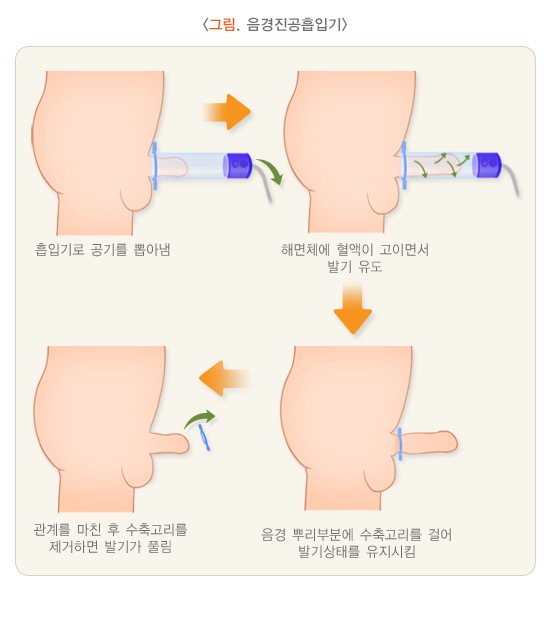 a2f1088d-b435-4eb3-87b1-fe67fa19c2d5.jpg 이미지