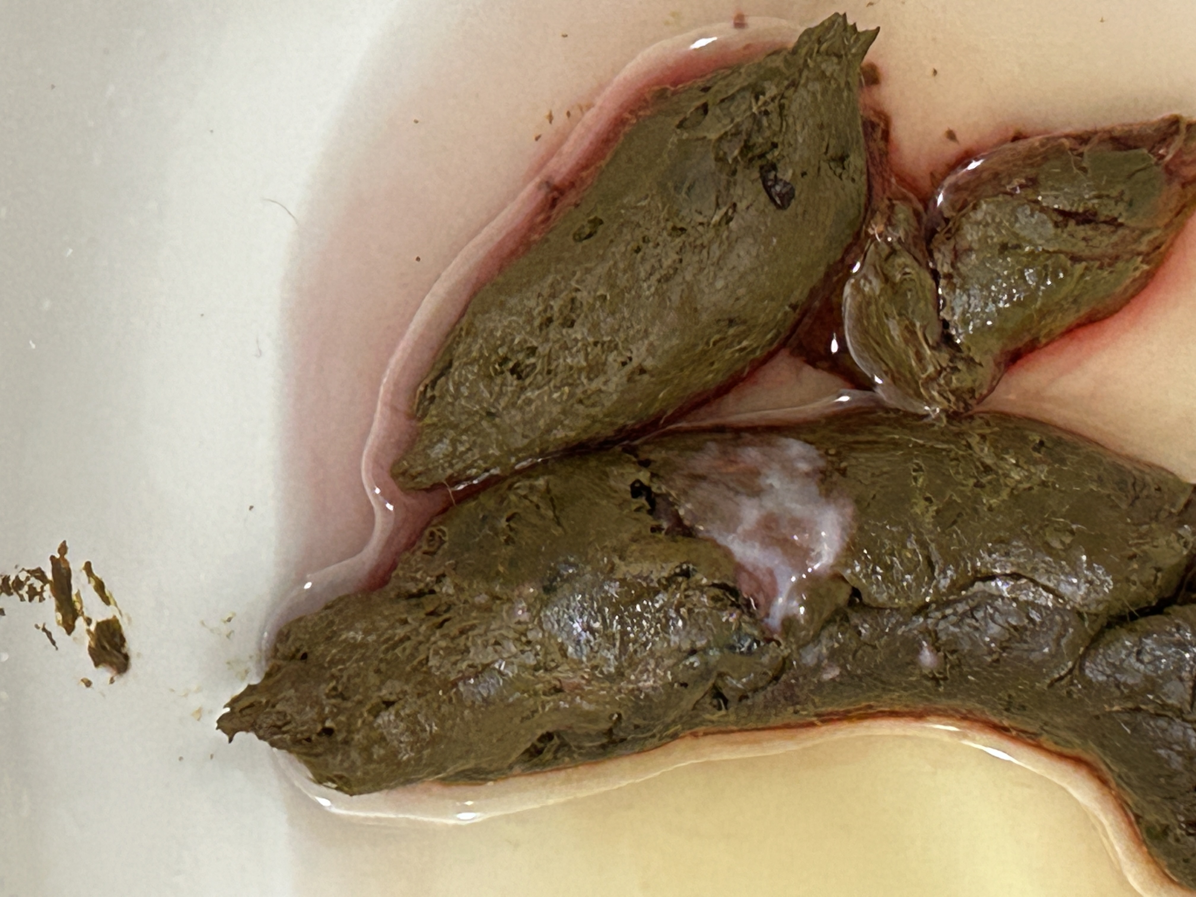 혈변인가요?내과 선생님들 문의 드립니다 ㅣ 궁금할 땐, 아하!